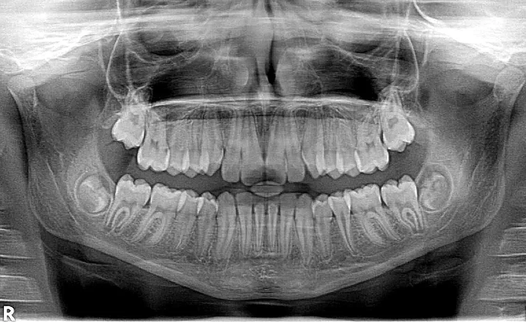 Teeth Tales: The Unique Identity Imprinted on Your Smile