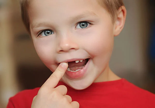 The Tale of Falling Milk Teeth: Why Do They Make Way for Permanent Teeth?